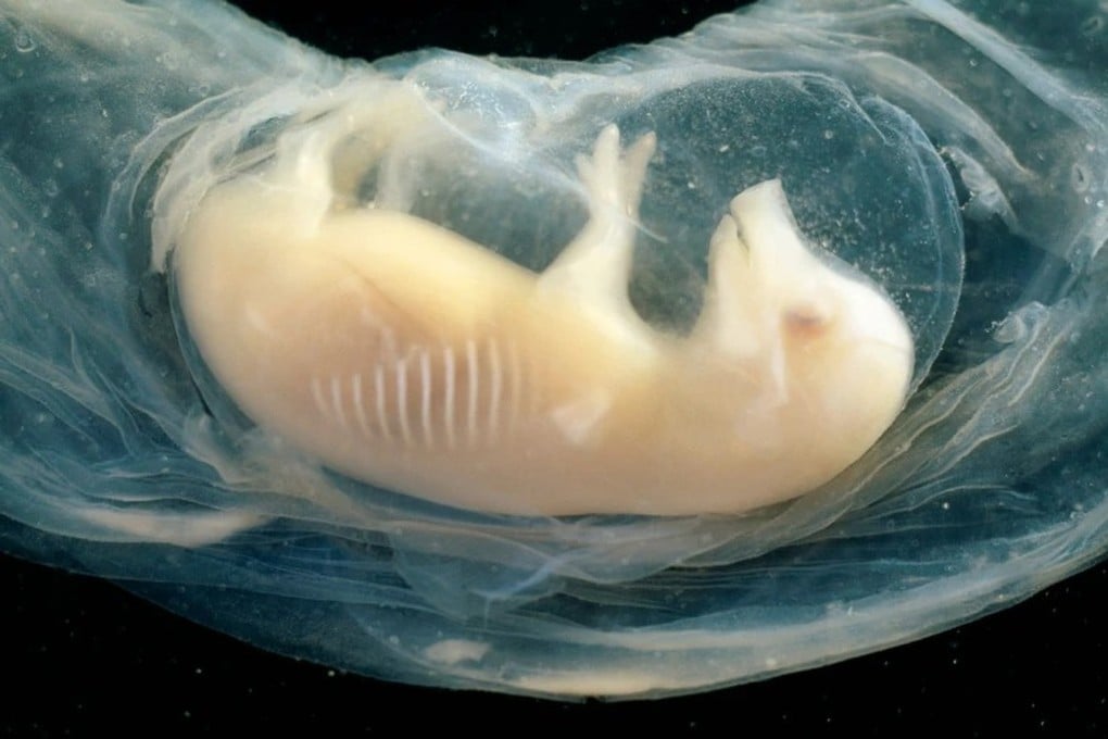 Ilmuwan Cina Berhasil Tanam Jantung Manusia Dalam Embrio Babi