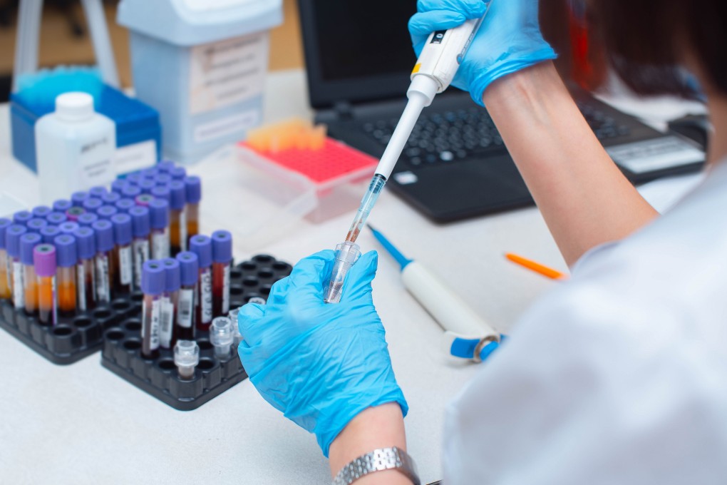 A ctDNA test may provide a more complete analysis than other cancer-screening tests, and detect tumours up to three years earlier than conventional tests. Photo: Shutterstock