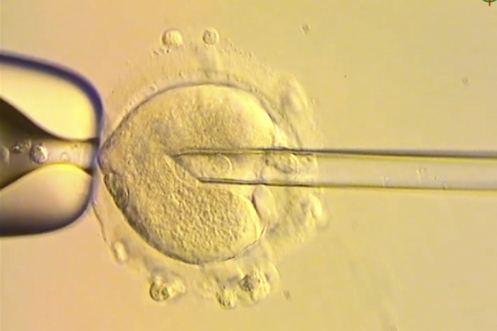 A nuclear genome from an egg carrying a mitochondrial DNA mutation being inserted into an egg donated by an unaffected woman. Photo: Newcastle Fertility Centre, Newcastle Hospitals NHS Foundation Trust via AP