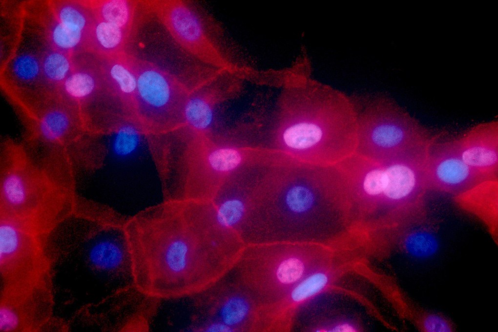 New Research from China Suggests Chemotherapy Could Speed Up Cancer Spread