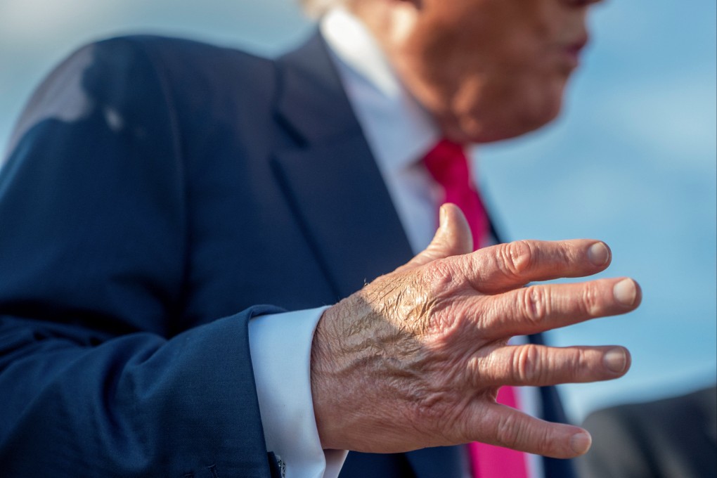 Make-up partially covers the back of US President Donald Trump’s right hand as he speaks to the media at Joint Base Andrews, Maryland, on Tuesday. Photo: Reuters