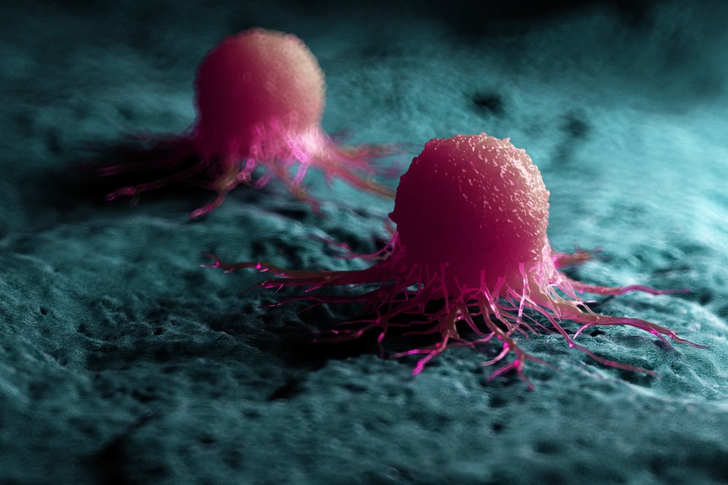 Researchers from the Chinese Academy of Sciences’ Institute of Nanoscience and the National University of Singapore are working on a cancer treatment that uses nanotechnology to attack tumours. Photo: Shutterstock
