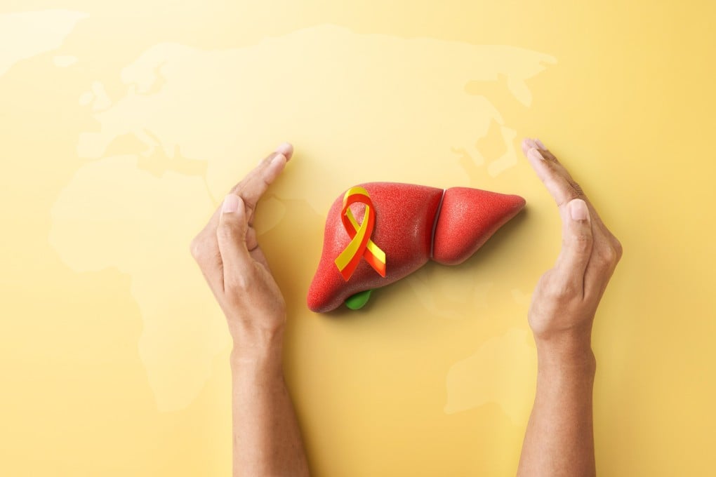 World Hepatitis Day, which falls each year on July 28, aims to raise awareness of the disease and the importance of prevention, screening, diagnosis and treatment. Photo: Shutterstock