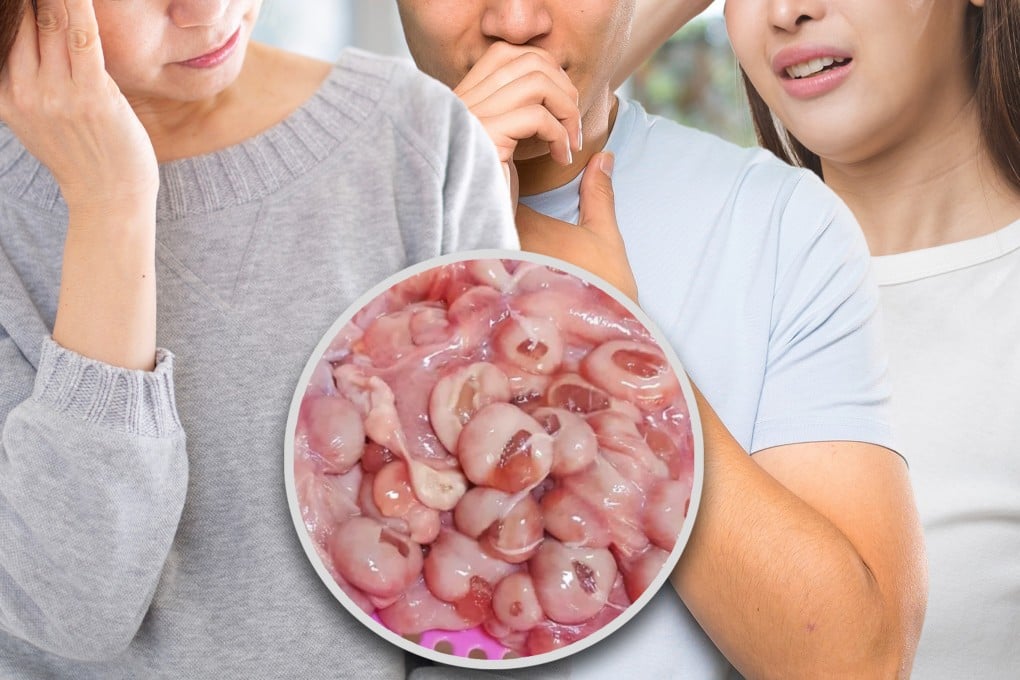 A group of people in China have been hospitalised with a bacterial infection after they ate what they believed to be “nutritious” cooked sheep placenta. Photo: SCMP composite/Shutterstock/Baidu