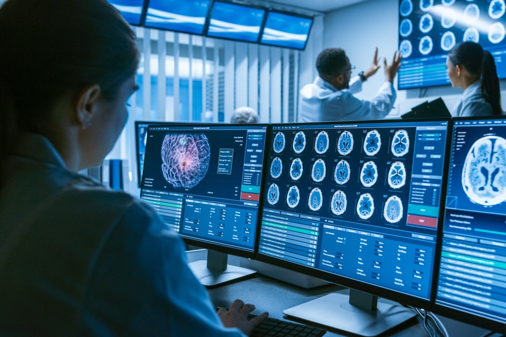 Scientists examine brain scan images in a laboratory. A new MRI tool called DunedinPACNI has been unveiled that can predict dementia risk and ageing through brain scans. Photo: Shutterstock