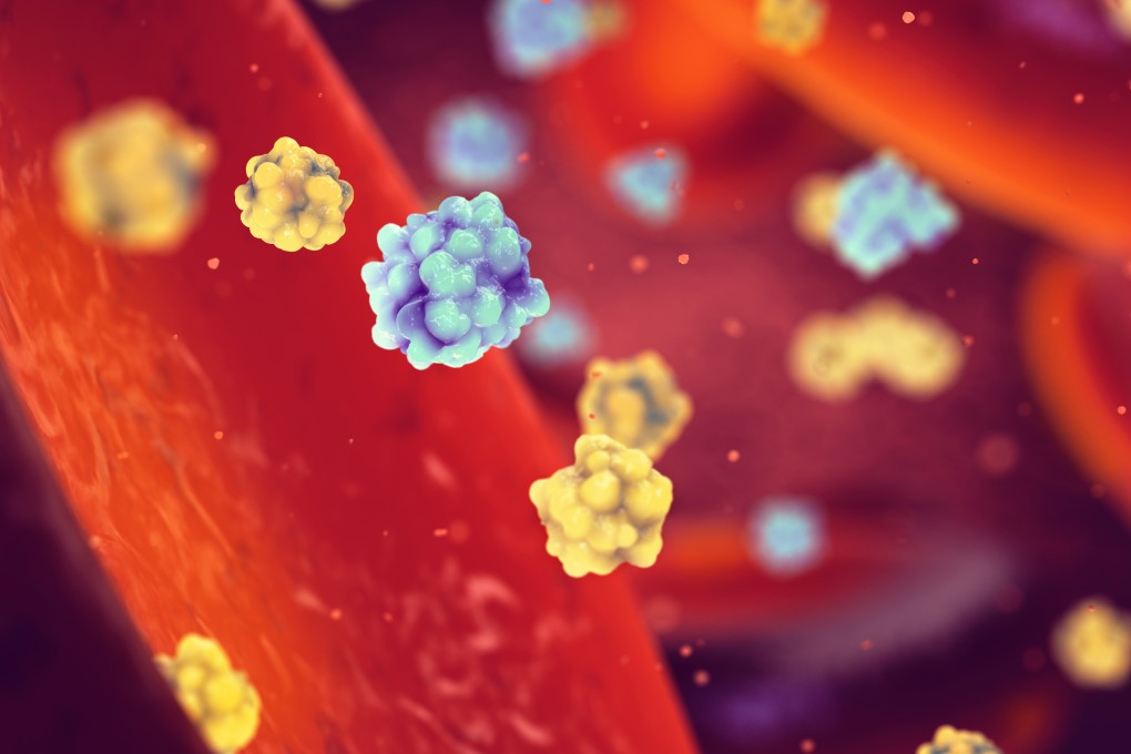 A molecule that seems to help cancer cells evade detection shows promise in protecting insulin-producing cells from autoimmune attack in type 1 diabetes. Photo: Shutterstock