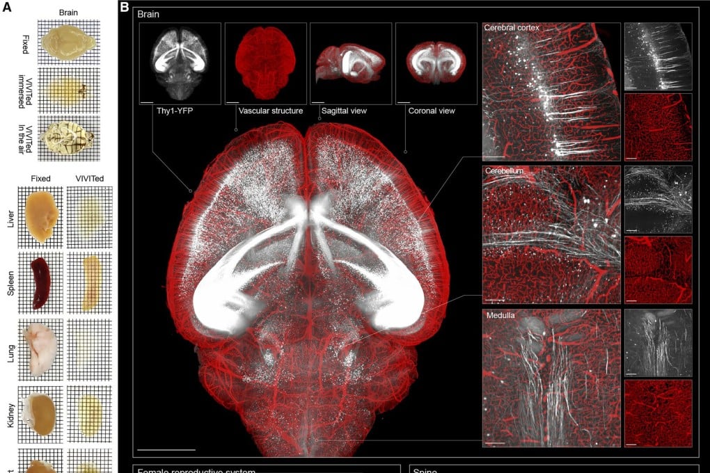 Scientists have long been looking for ways to make biological tissues transparent so that they can study organs without damaging their internal structures by cutting through them. Photo: Handout