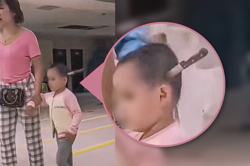A shocking online video has showed a mother taking her three-year-old daughter to the hospital with a fruit knife lodged in the child’s head. Photo: SCMP composite/Douyin