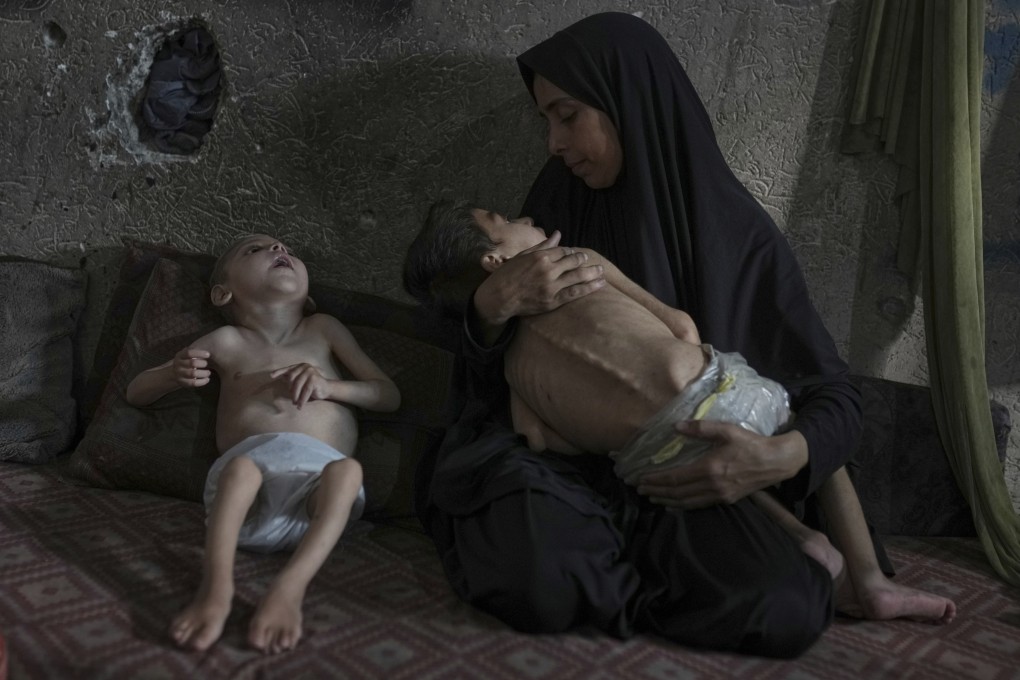 Samah Matar poses for a photo with her sons, Yousef, 6, in her arms, and Amir, 4, affected by malnutrition and cerebral palsy, at a UN-run school in Gaza City. Photo: AP