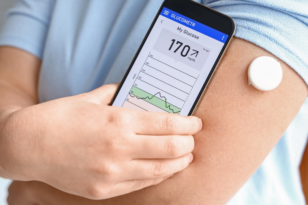 Continuous glucose monitors use tiny sensor wires inserted under the skin of your upper arm or abdomen with an applicator to measure a person’s blood sugar levels. Readings are displayed on a receiver or your smartphone. Photo: Shutterstock