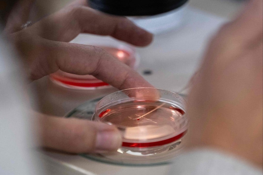 An Israeli hospital says it has achieved a breakthrough in cultivating kidneys in laboratories. Photo: AFP
