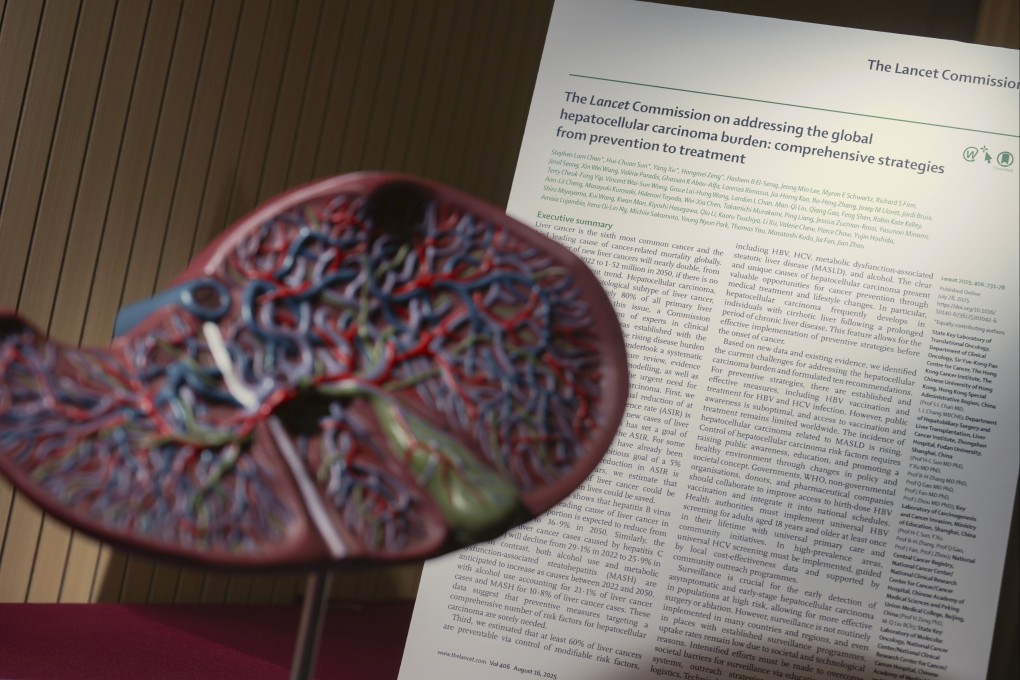 The Lancet Commission on liver cancer study found that by 2050, about one in three liver cancer cases will be caused by alcohol use and fatty liver, up from 26 per cent in 2022. Photo: May Tse