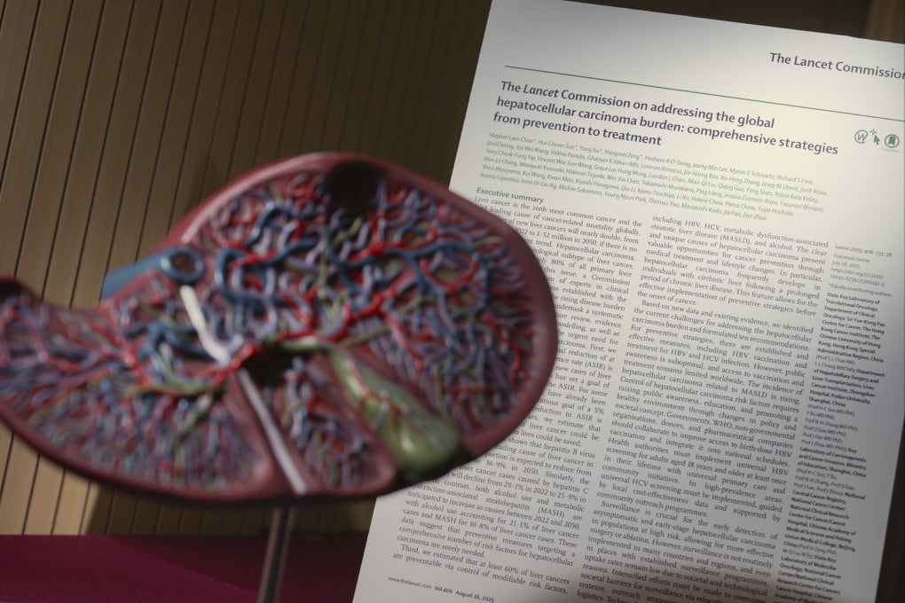 The Lancet Commission on liver cancer study found that by 2050, about one in three liver cancer cases will be caused by alcohol use and fatty liver, up from 26 per cent in 2022. Photo: May Tse
