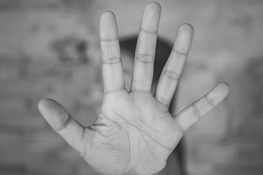 The hand of an abuse victim is pictured. The suspects face a jail term of up to 20 years and whipping if convicted. Photo: Shutterstock