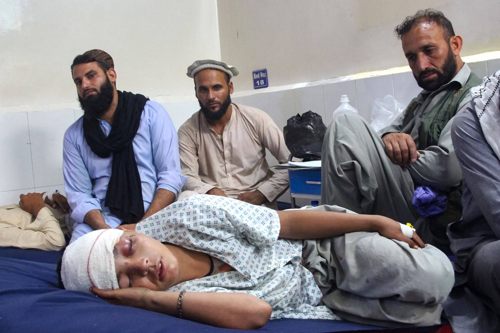 An injured Afghan boy receives treatment at a hospital after an earthquake in Afghanistan’s Jalalabad. Photo: AFP