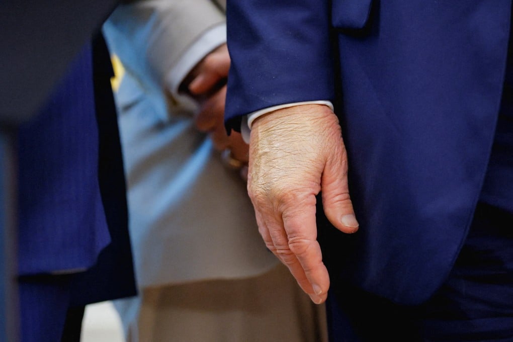 US President Donald Trump’s right hand on Tuesday. In recent days, a bruise had been visible on the hand. Photo: Reuters