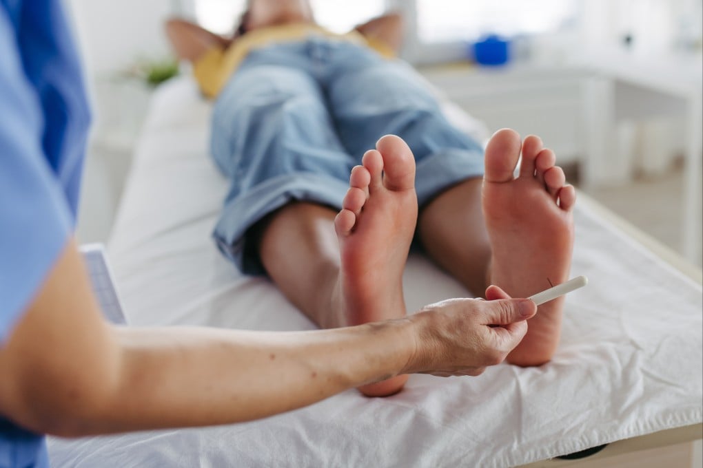 A doctor tests for loss of sensation in a diabetic patient’s feet. Photo: Getty Images