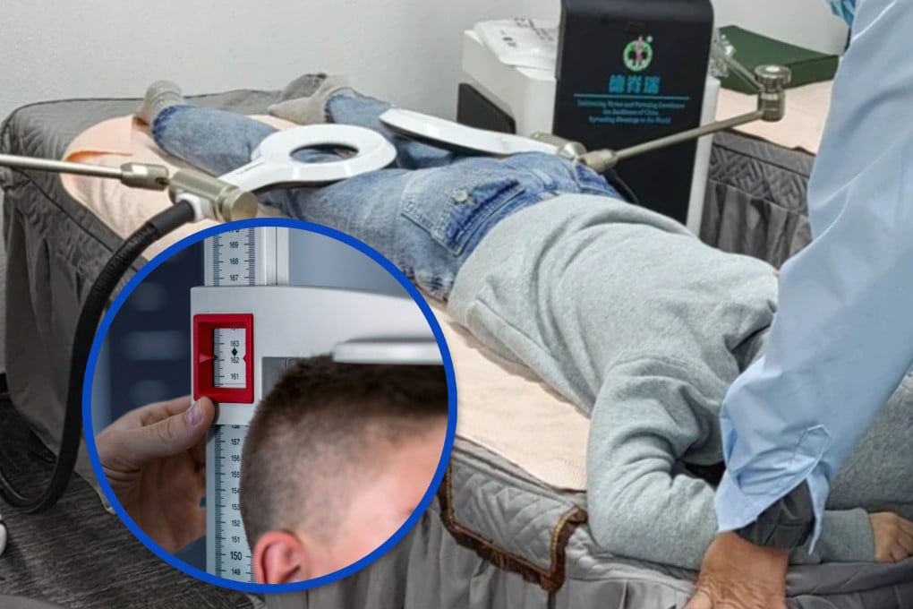 A 16-year-old Chinese boy grew from 165cm to 166.4cm after body lengthening treatment, but returned to his original height two weeks post-therapy. Photo: SCMP composite/Shutterstock/RedNote