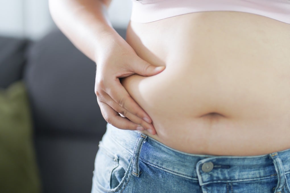 An analysis of Korean health data shows obesity rose by seven percentage points among adults from 2013 to 2024. Childhood rates more than doubled during the same period, with children more likely to be obese if their parents were. Photo: Shutterstock