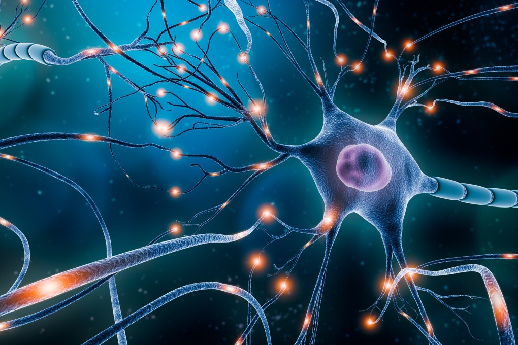 A 3D artist’s rendering of a neuronal network.  Huntington’s is a fatal neurodegenerative disease caused by a single genetic mutation. Image: Shutterstock