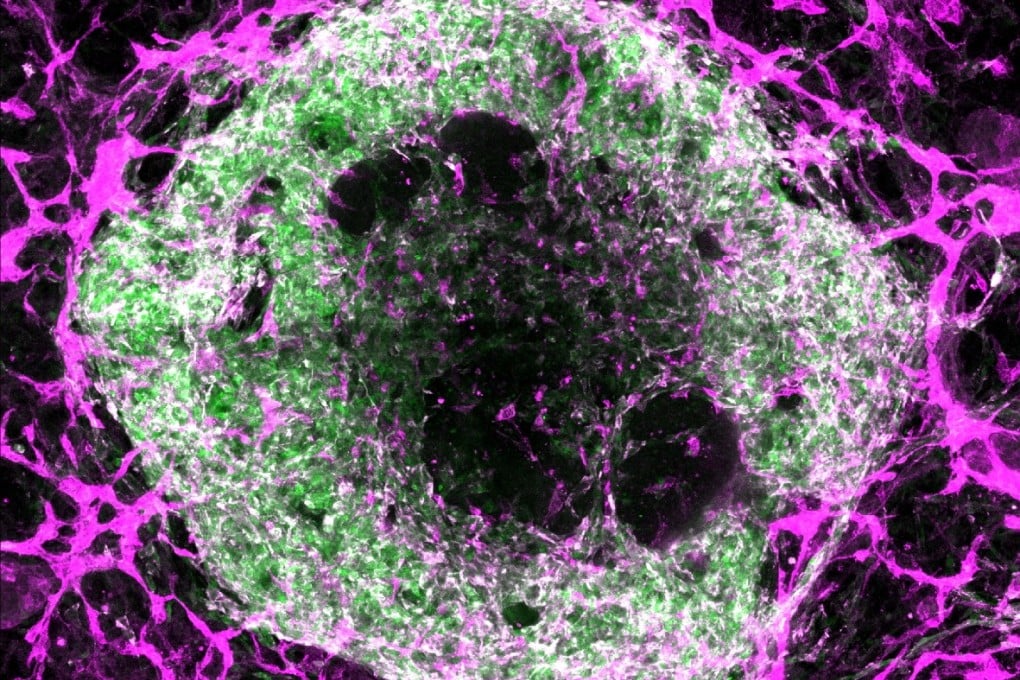 A two-week-old heart organoid with the potential to generate its own blood vessels. Photo: Stanford University