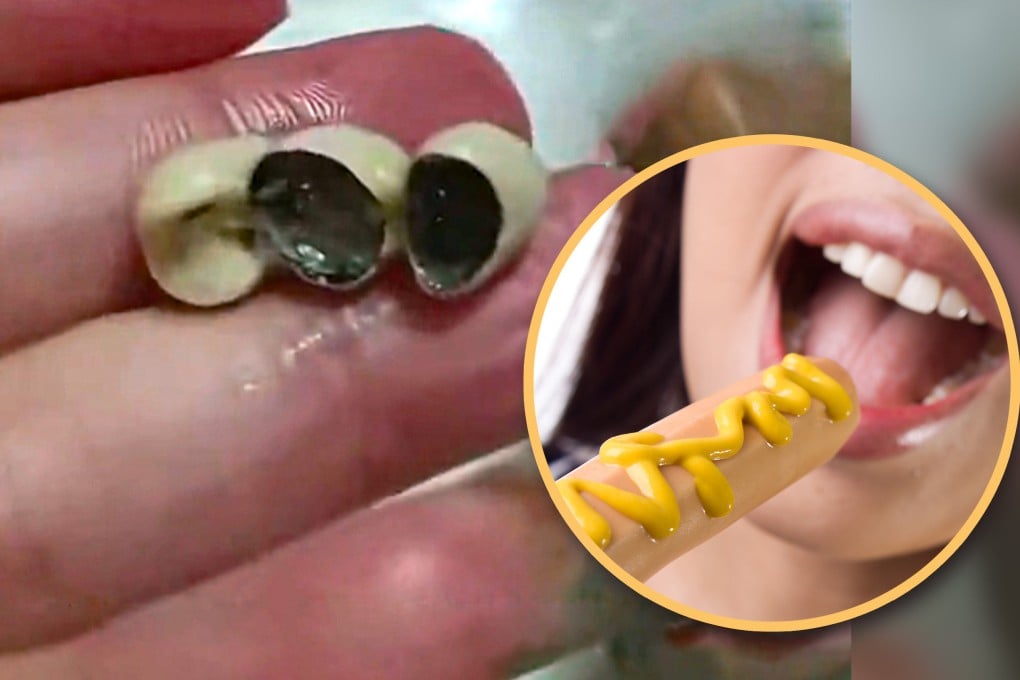 Food safety issues have resurfaced in China following alarming reports from Jilin and Guangdong provinces, where consumers found foreign objects resembling teeth in sausages and dim sum. Photo: SCMP composite/Shutterstock/Douyin