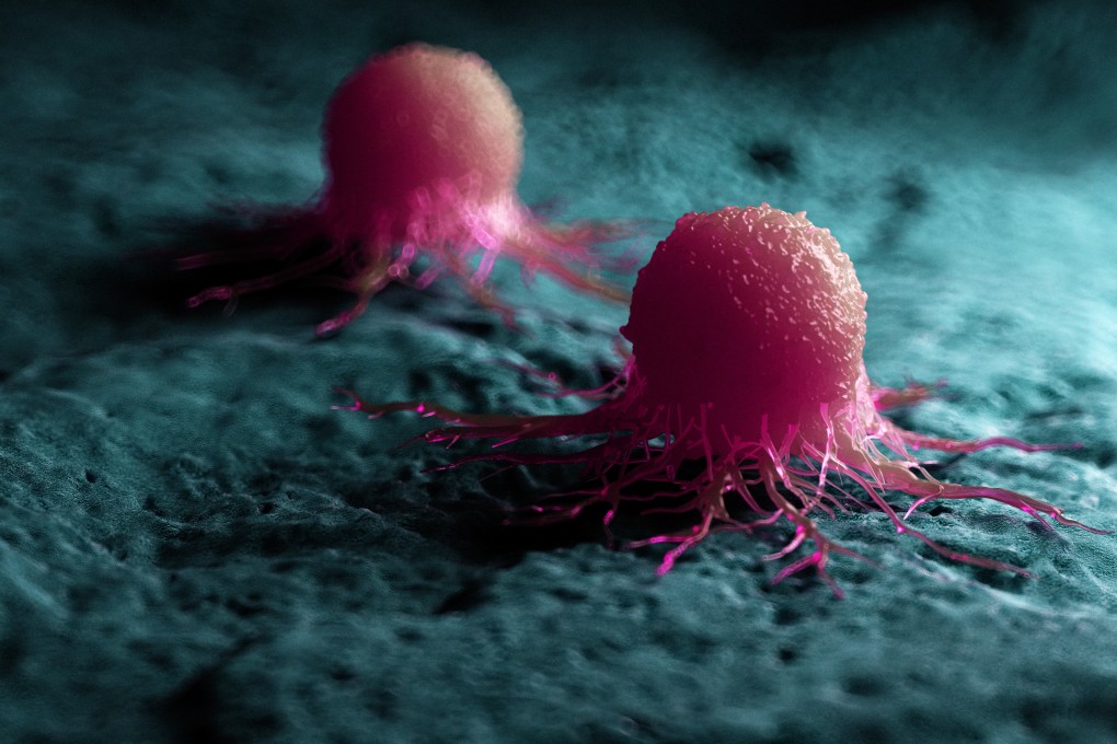 Researchers have identified two protein enzymes that play a crucial role in helping prostate cancer cells grow and resist treatment. They found combining drugs that block the two enzymes with a widely used prostate cancer medication significantly boosted the anticancer response. Photo: Shutterstock