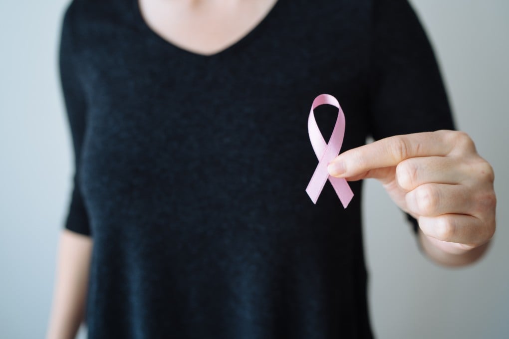 Breast cancer was the most common form of cancer among women in Hong Kong in 2022, according to the Centre for Health Protection. Photo: Getty Images