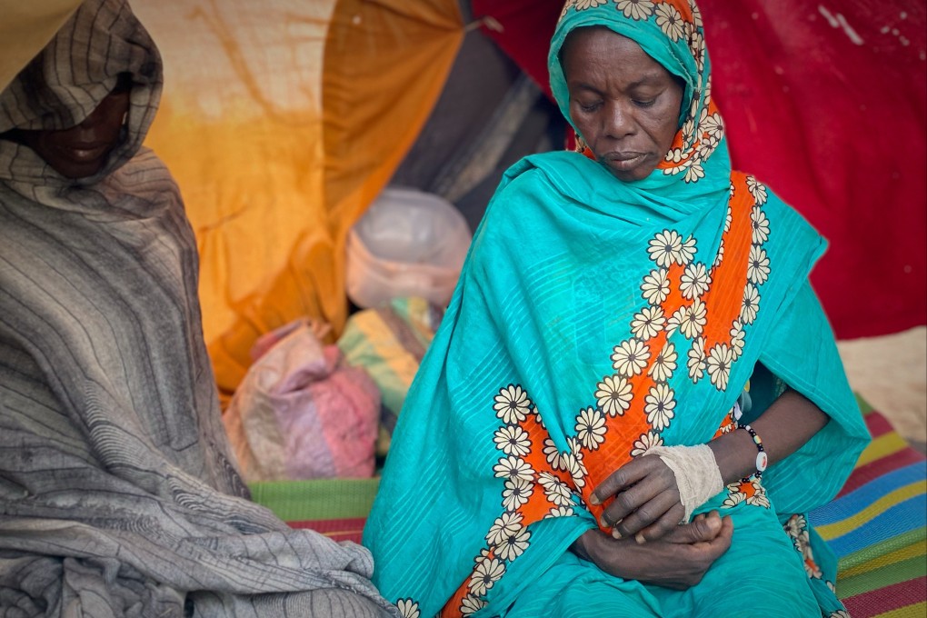 An injured Sudanese woman who fled El-Fasher, after Sudan’s paramilitary forces killed hundreds of people in the western Darfur region, sits in a tent at a camp in Tawila, Sudan, on Friday. Photo: AP