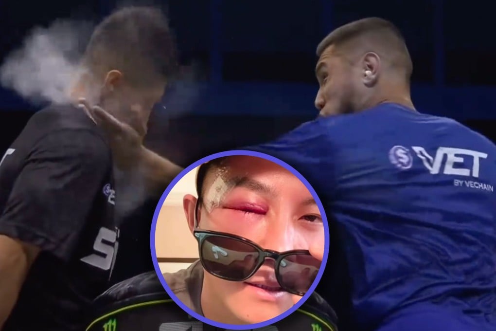 China’s first contestant in a Power Slap competition was knocked unconscious and needed five stitches in a face wound. Photo: SCMP composite/Douyin/RedNote
