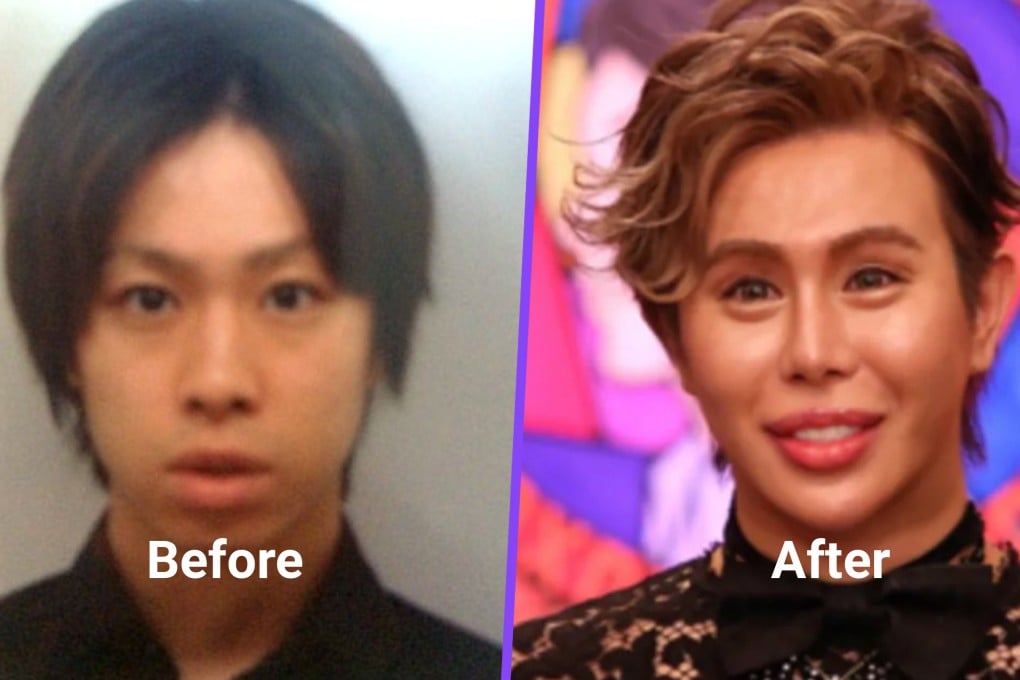 A Japanese man has spent US$651,000 on plastic surgery to become “the most beautiful person in the world” after enduring years of bullying because of his appearance. Photo: SCMP composite/QQ.com