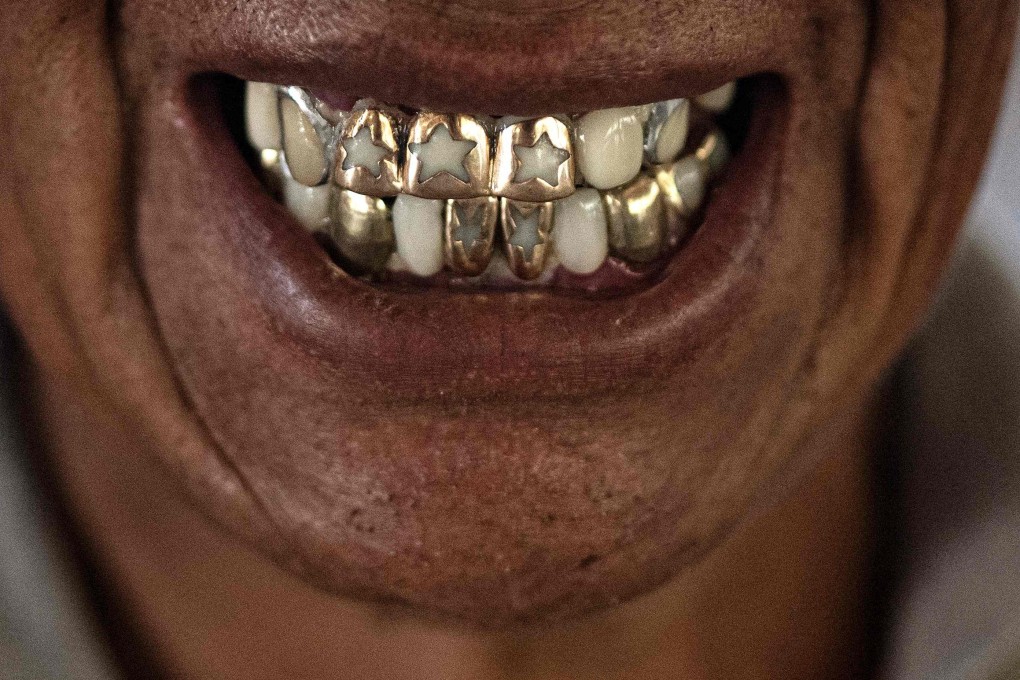 A man in Bolivia shows off his gold decorated teeth. Photo: AFP