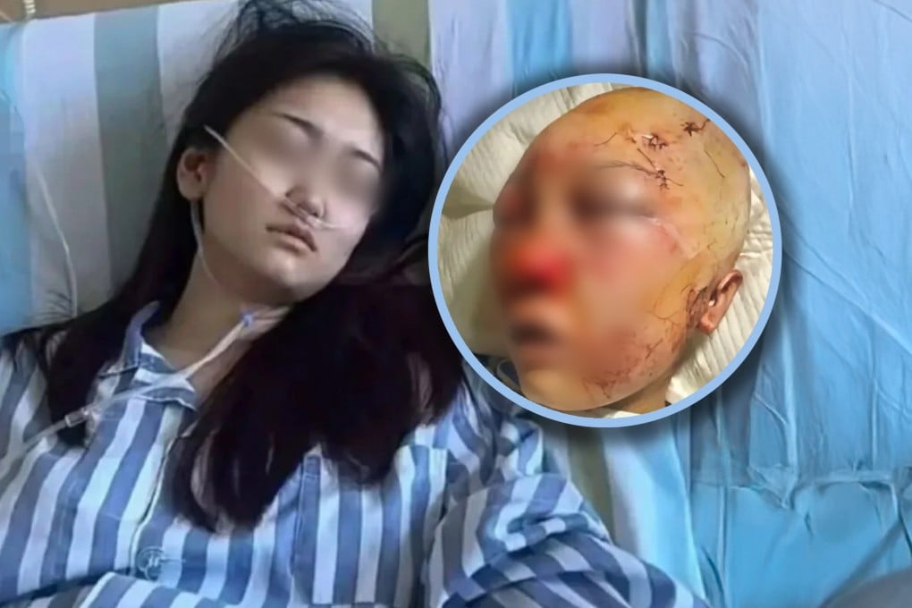 A young woman in China who was brutally attacked in a public toilet three years ago has been diagnosed with leukaemia and is desperately seeking online donations to pay for her medical treatment. Photo: RedNote/Douyin