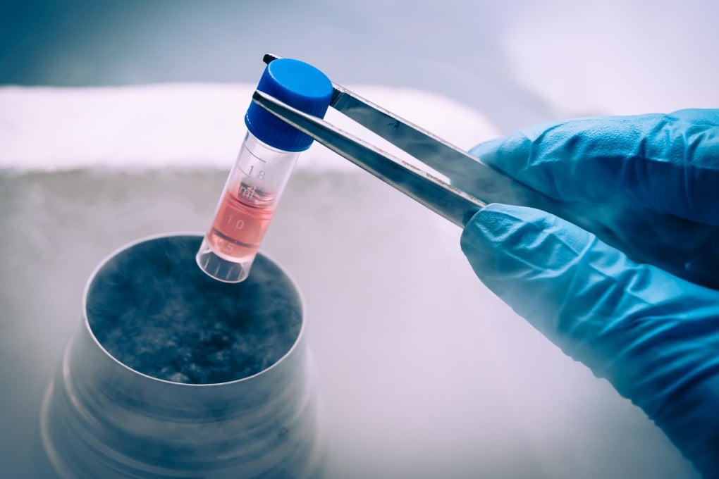 Terobosan Terbaru Terapi Sel Punca untuk Mengatasi Parkinson di Cina