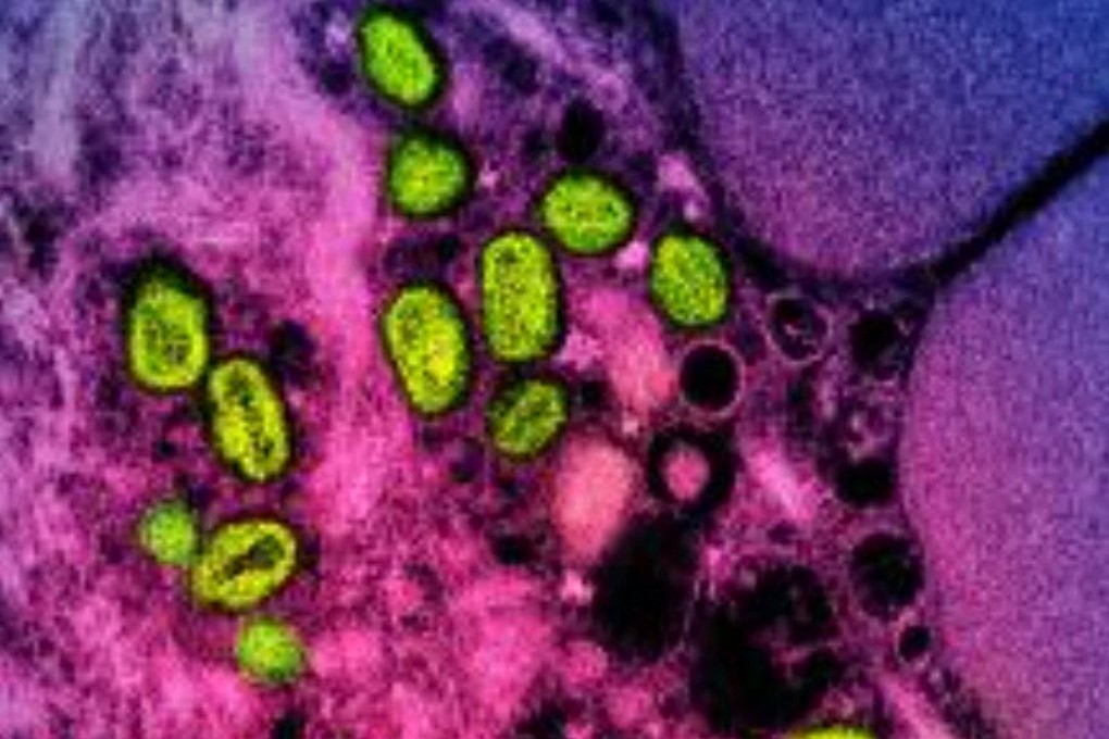 A colorised electron micrograph shows green mpox particles within a pink and purple infected cell cultured in a lab. Photo: National Institute of Allergy and Infectious Disease/AFP