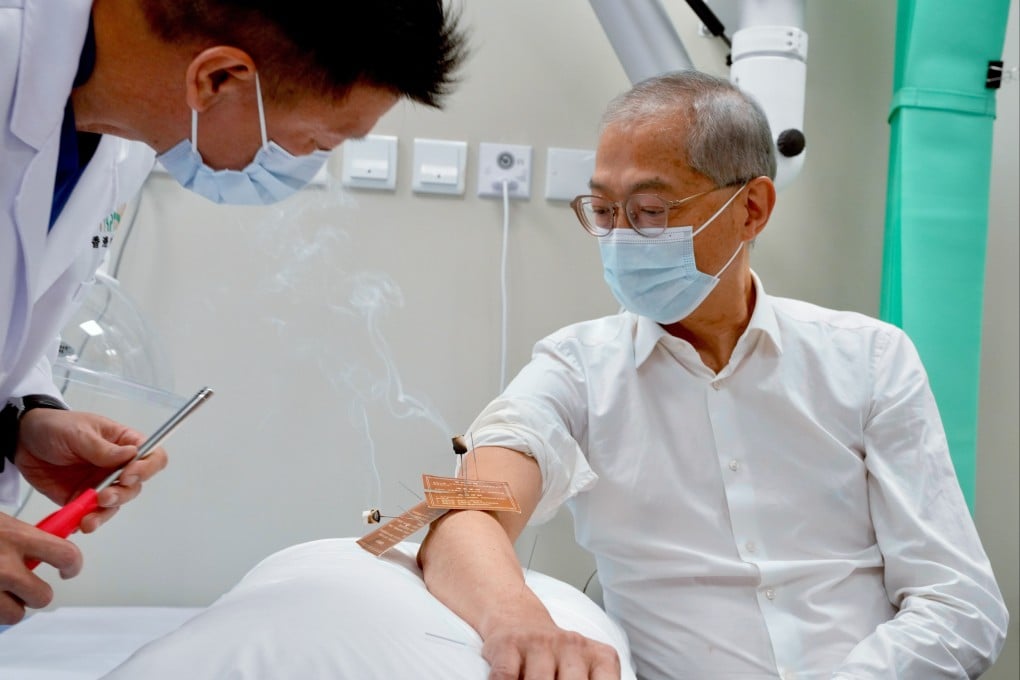 Secretary for Health Lo Chung-mau receives moxibustion therapy at the new Chinese medicine hospital in Tseung Kwan O. Photo: SCMP Pictures