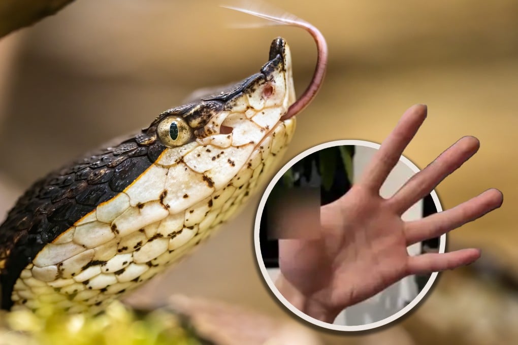 A man who hand-fed his pet snake suffered a serious bite on the thumb, leading to the amputation of the digit. Photo: Shutterstock/CCTV