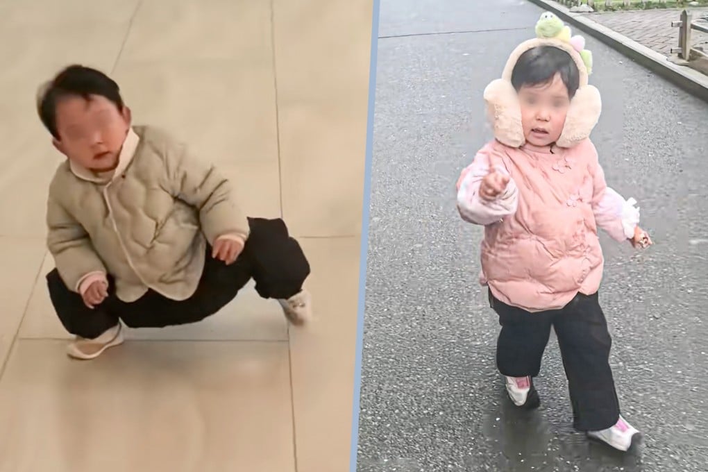 A mother has documented her toddler daughter’s rehabilitation from a hip joint condition, gaining online support. Photo: Douyin