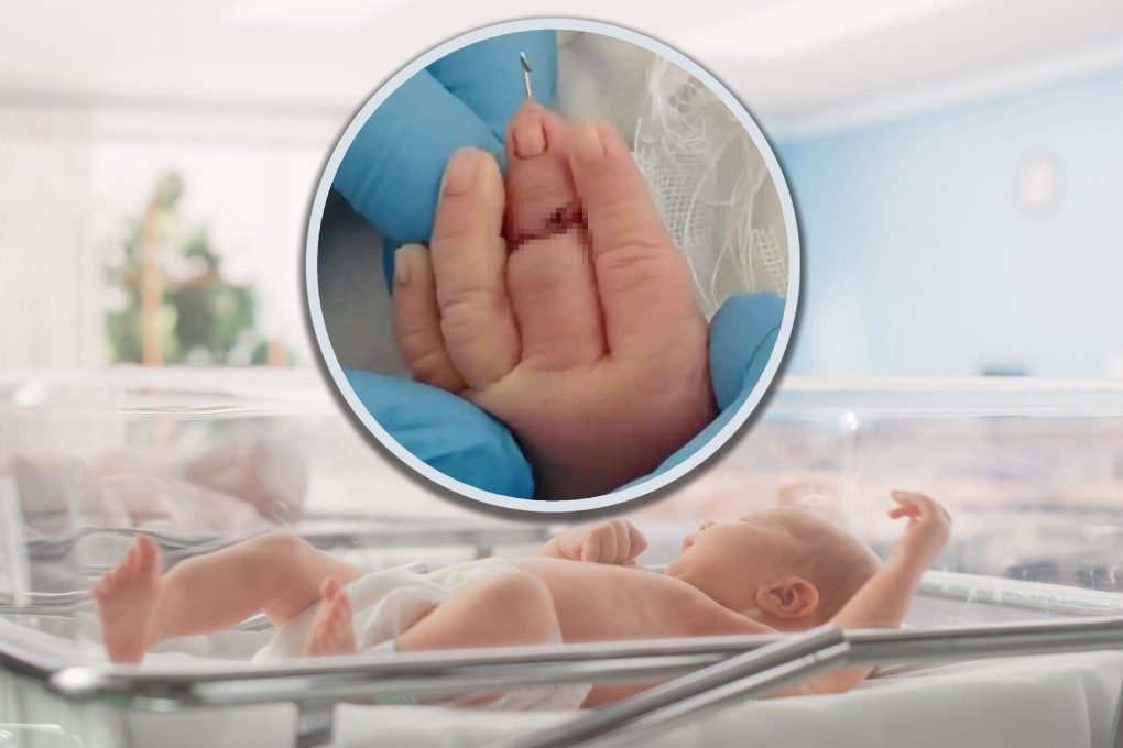 A Chinese midwife accidentally severed a baby’s middle finger during a caesarean section and the infant was transferred to a larger hospital for surgery. Photo: SCMP composite/Shutterstock/Baidu