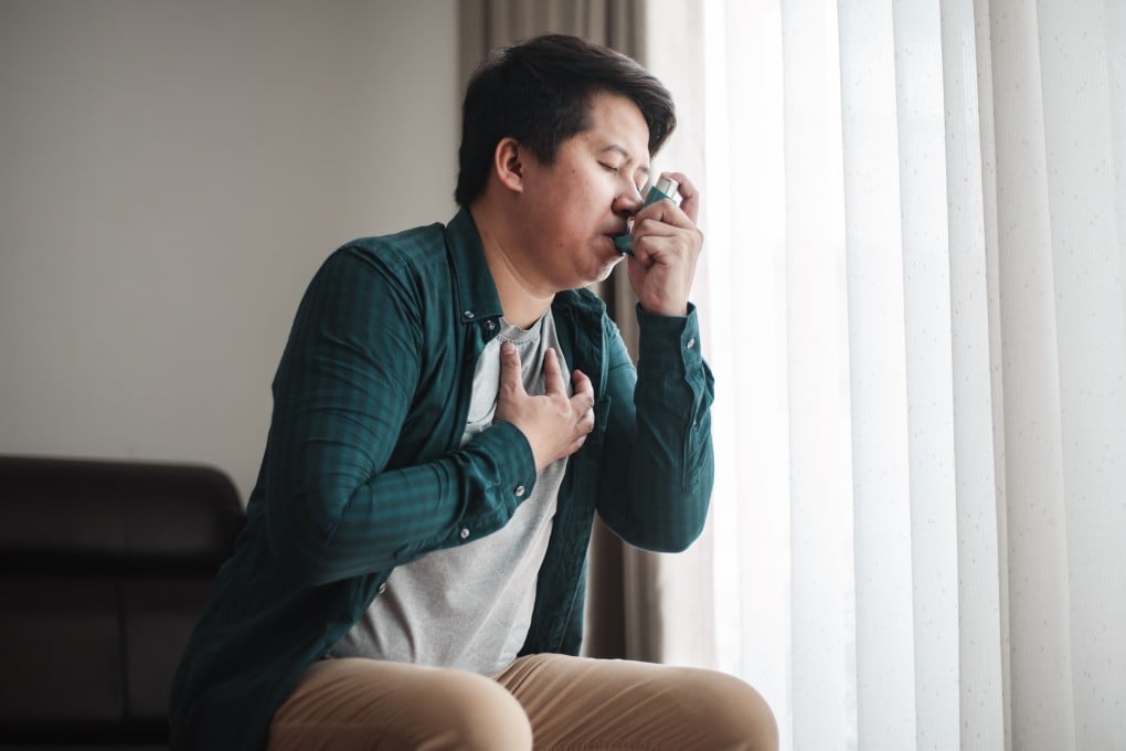 Scientist Yin Jianhua says a Chinese team’s research shows that asthma is closely related to the immune system, suggesting that immune-related treatments could be a viable option for therapy. Photo: Shutterstock