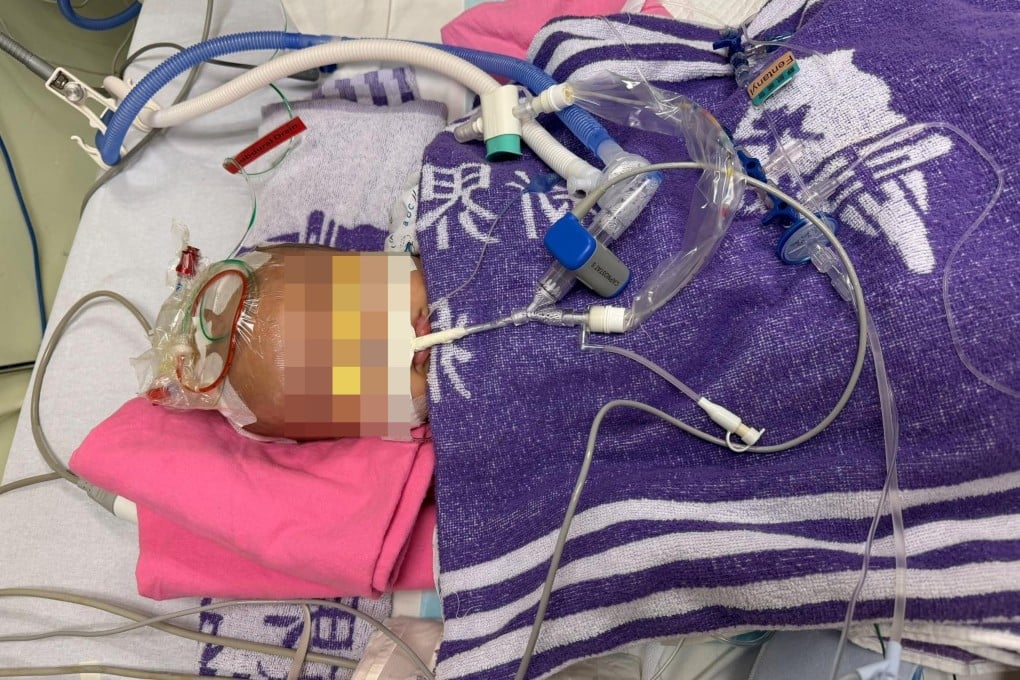 The four-month-old is currently in the intensive care unit of Prince of Wales Hospital after undergoing emergency brain surgery. Photo: Handout