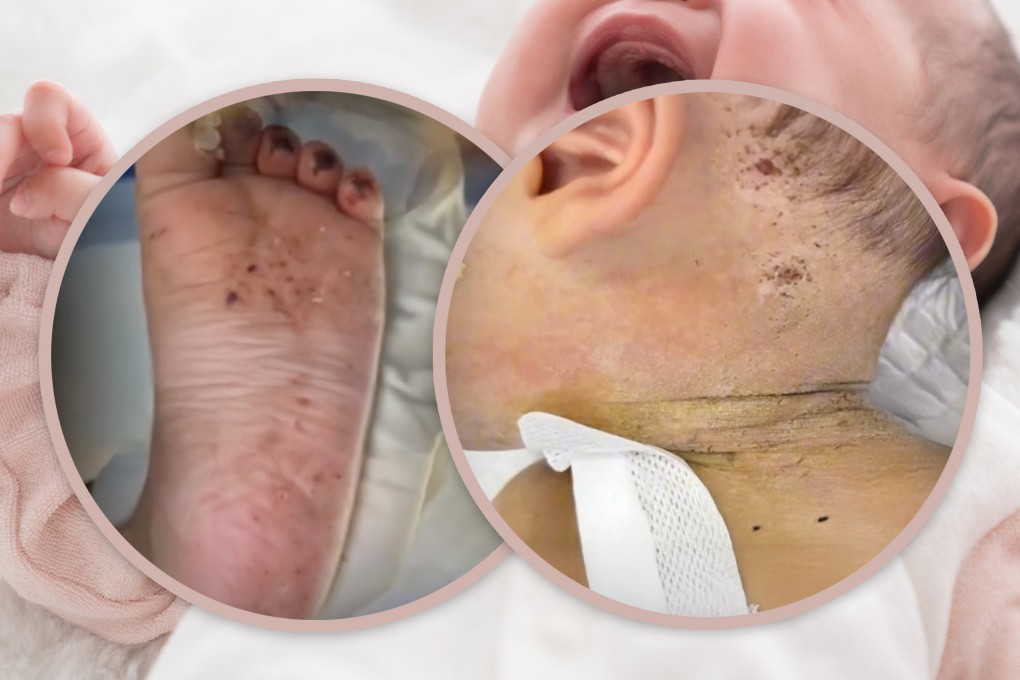 A baby boy in China was rushed to hospital covered in needle marks after being brutally punished by his mother, who stabbed him repeatedly for misbehaving. Photo: SCMP composite/Shutterstock/Douyin