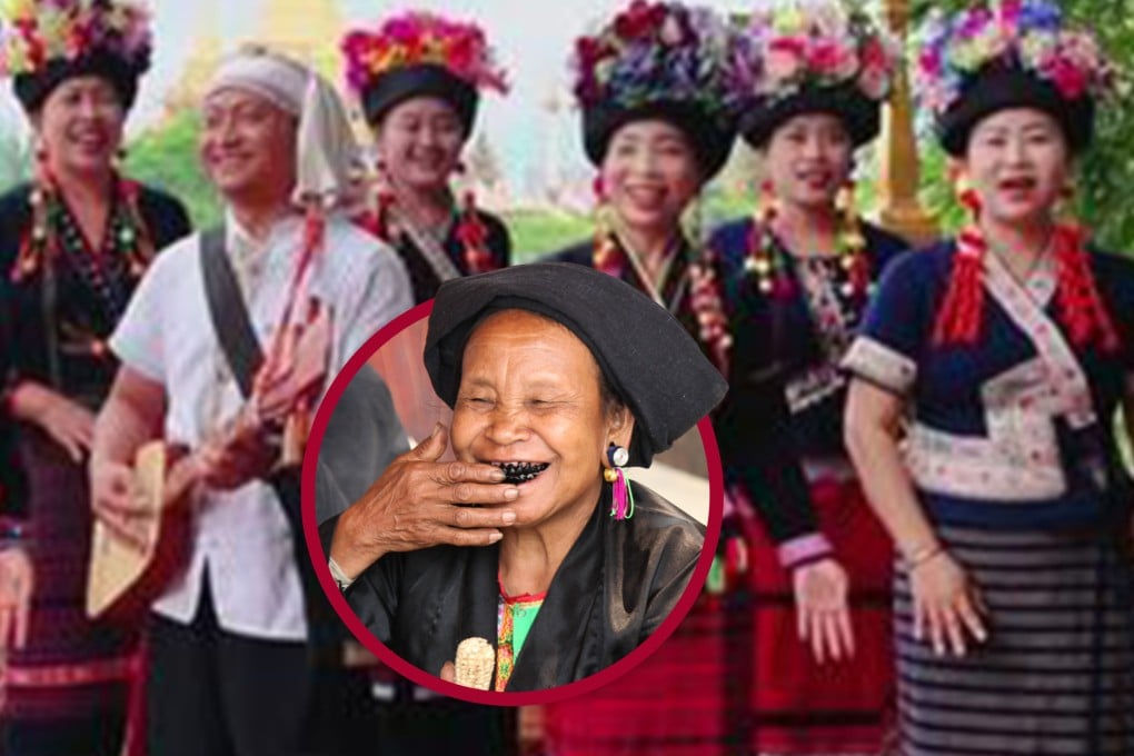 For China’s Bulang ethnic group the blackening of teenagers’ teeth is a rite of passage. Photo: SCMP composite/Douyin/mzzyk.com