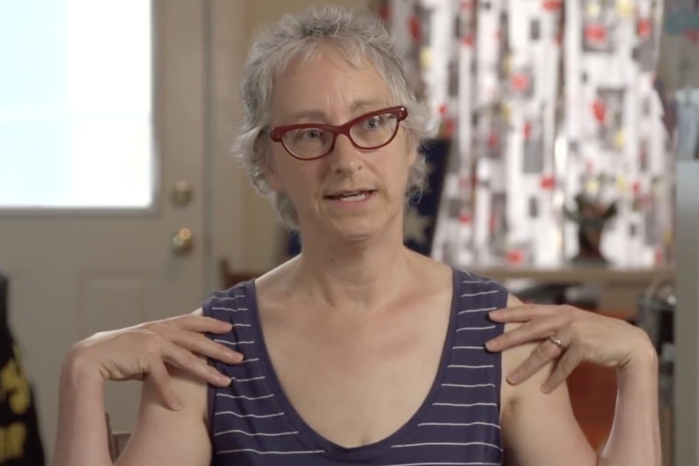 Breast cancer survivor Christine Cosby explains how she built upper-body strength during prehabilitation before cancer treatment. Prehab empowers cancer patients with exercise, nutrition, and mental support, enhancing recovery and survival rates. Photo: YouTube/AACRNews