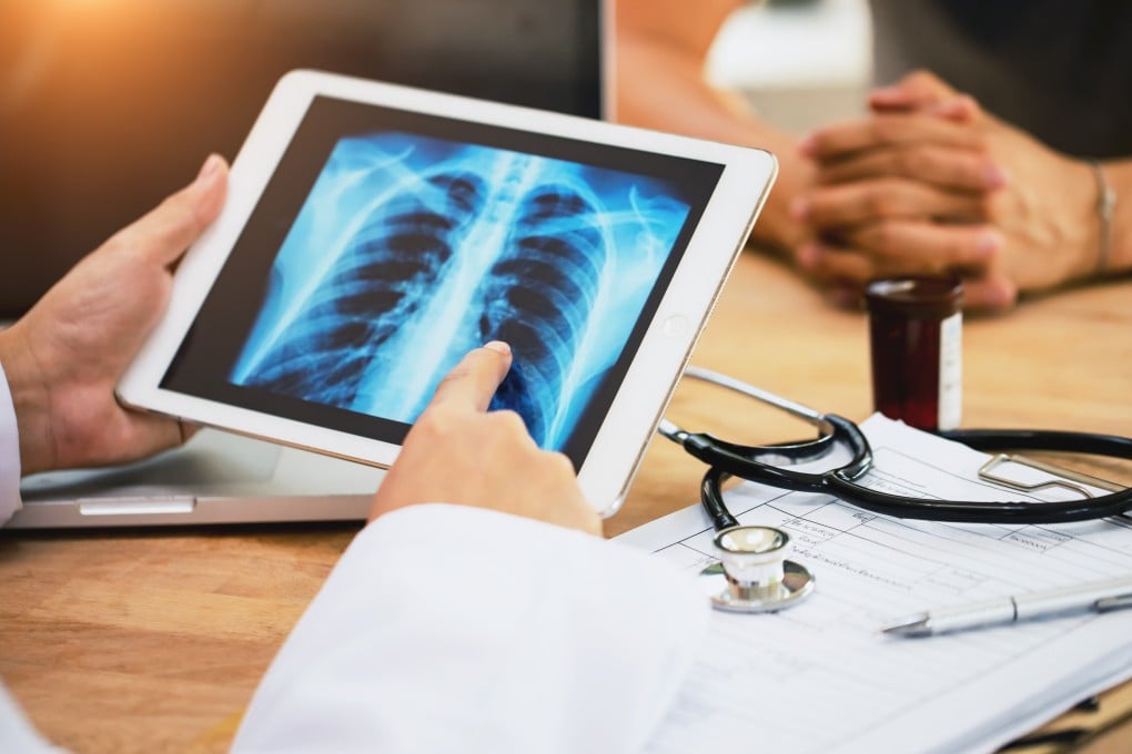 Lung cancer is the most common and deadliest cancer in Hong Kong. Photo: Getty Images