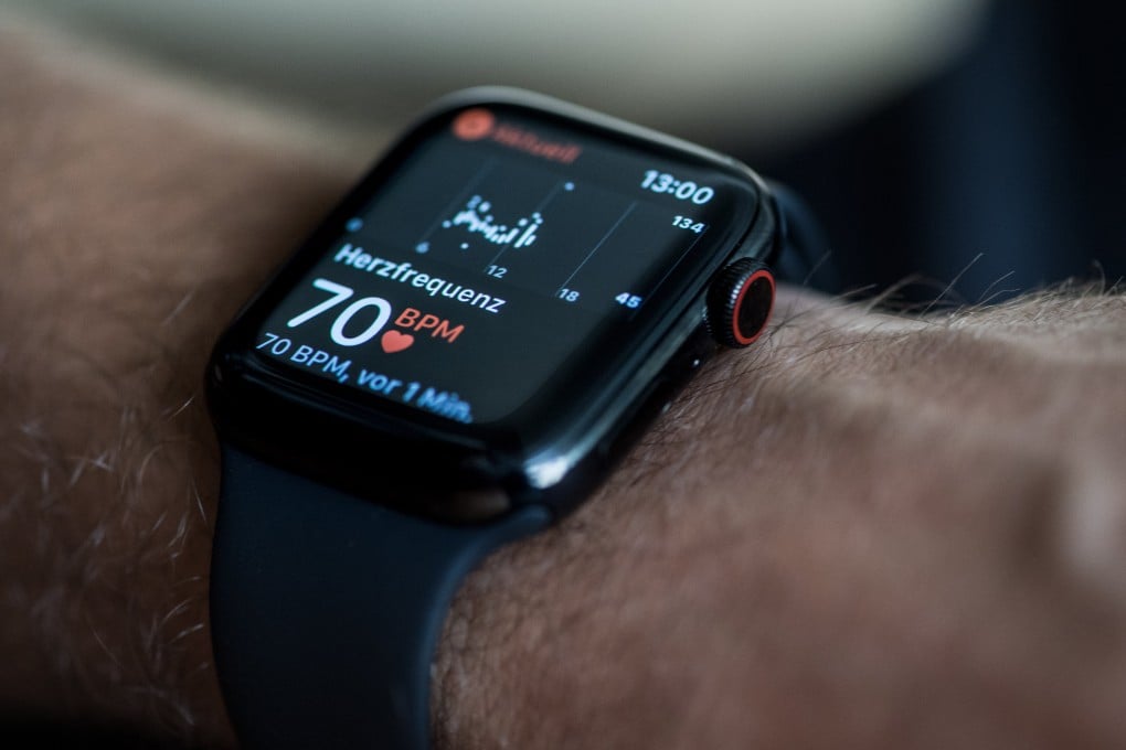 The Apple Watch fails to alert 59 per cent of people with undiagnosed high blood pressure that they possibly have hypertension, according to the company’s own data. US researchers say this could lead to missed opportunities for treatment. Photo: dpa