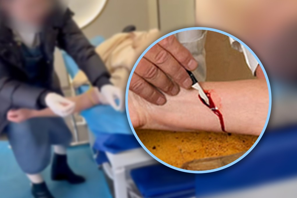 The Chinese authorities have cracked down on self-proclaimed doctors who have been performing “bloodletting therapy”, claiming it can remove evil energy. Photo: SCMP composite/Weibo/Zhihu