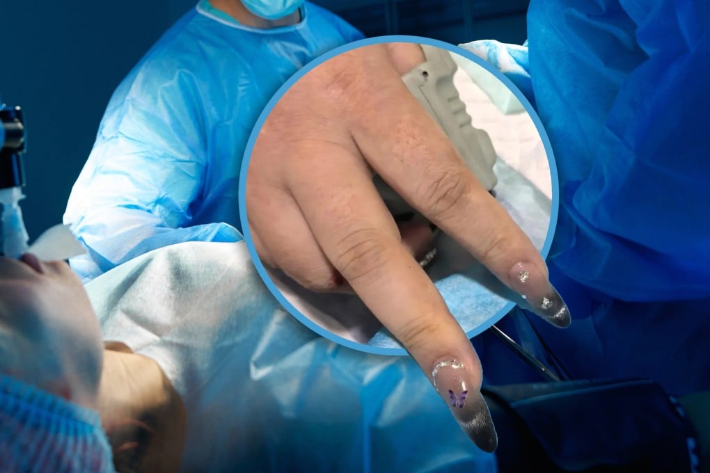A Chinese woman who suffered a heart attack had to have her press-on nails removed before she could undergo emergency treatment. Photo: SCMP composite/Shutterstock/Weibo