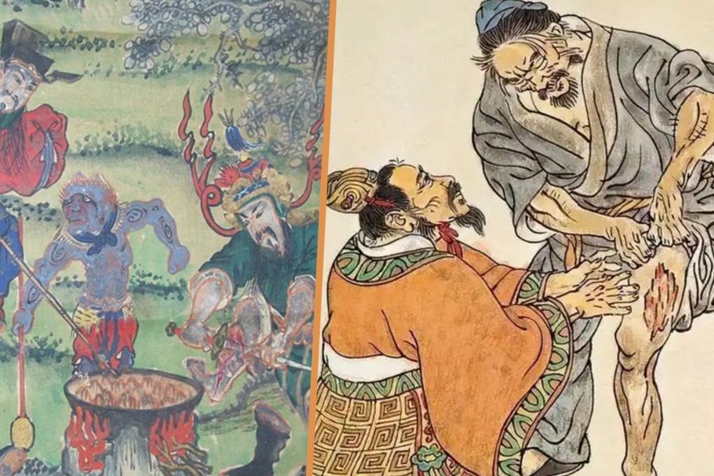 In ancient China, a traditional folk practice involved individuals self-mutilating by cutting flesh from their thighs to treat the illnesses of close relatives, demonstrating deep filial piety. Photo: SCMP composite/Sohu/Baidu