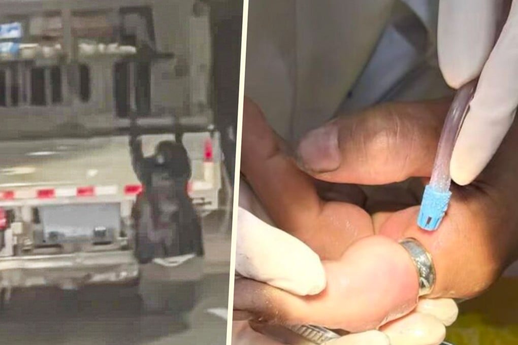 In China, a wife suspected her husband of cheating and clung to his truck to follow him; a woman needed a dentist’s help to remove a stuck ring and a man threatened divorce after a male doctor examined his pregnant wife. Photo: SCMP composite/Douyin/Jimu